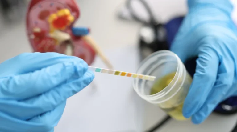 urine cotinine test