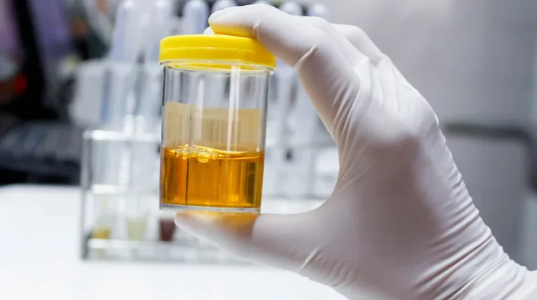 urine cytology test
