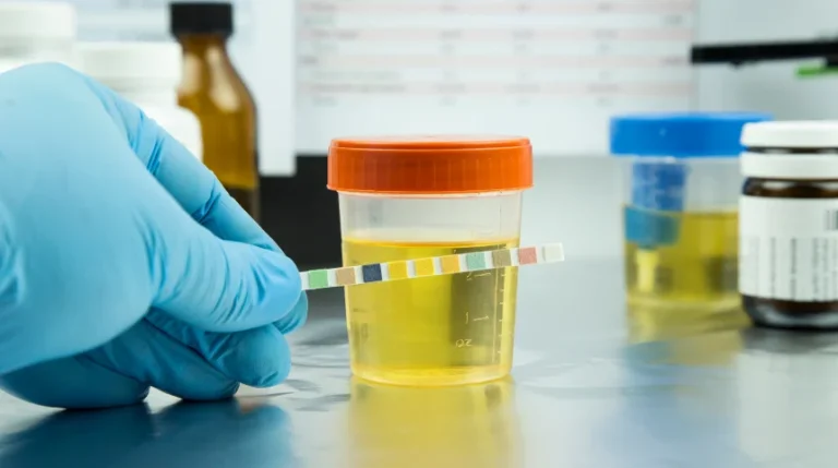 urine drug test