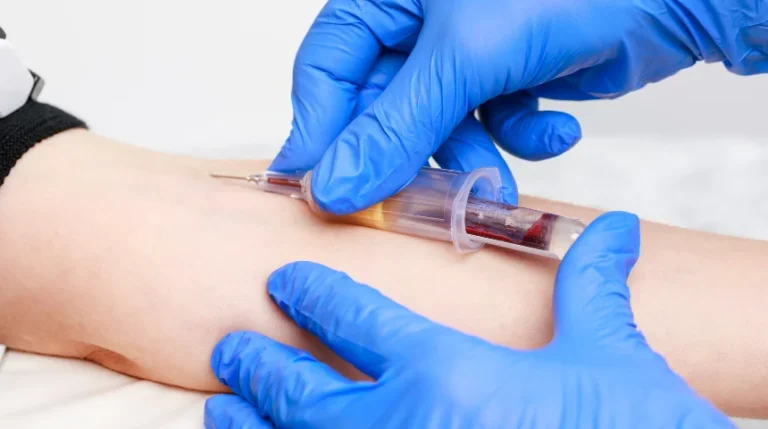 vascular biopsy