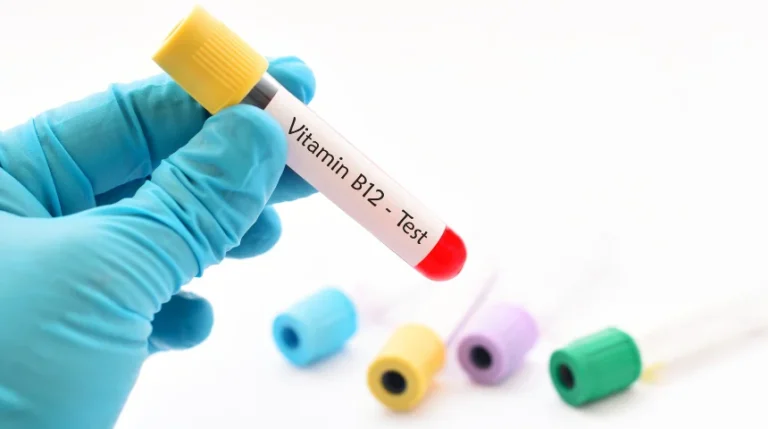 Vitamin B12 Test | mediSuggest