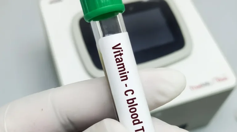 vitamin c test
