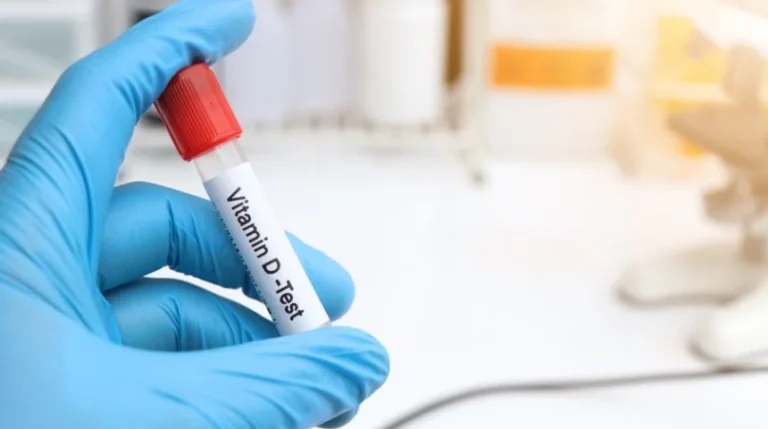 Vitamin D Test | mediSuggest