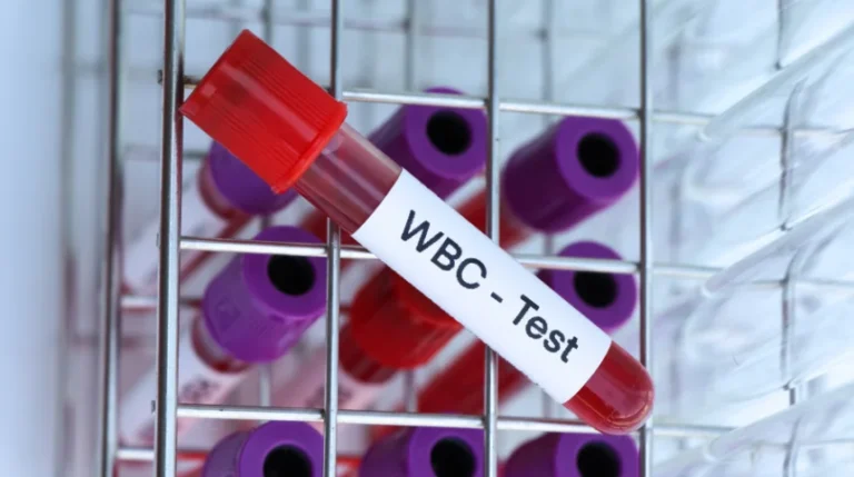 WBC Blood Test | mediSuggest