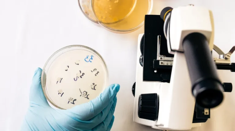 yeast infection test