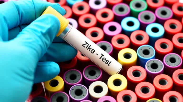 zika virus test