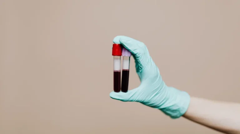 factor x test | mediSuggest