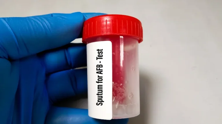 sputum afb test