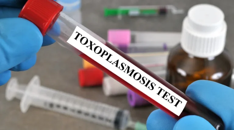 toxoplasmosis antibody test