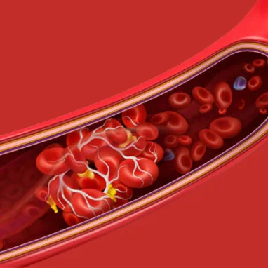 Typhoid