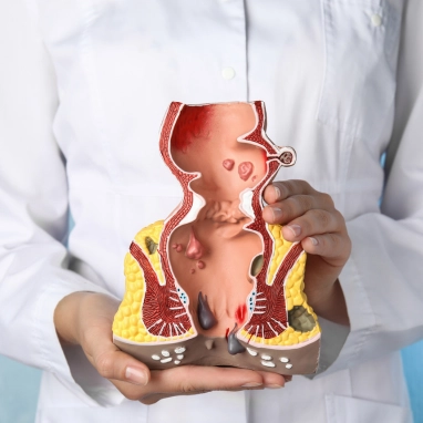 sphincteroplasty surgery in india